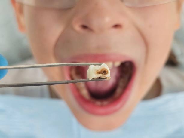 Best Pediatric Emergency Dentist in Croton On Hudson, NY